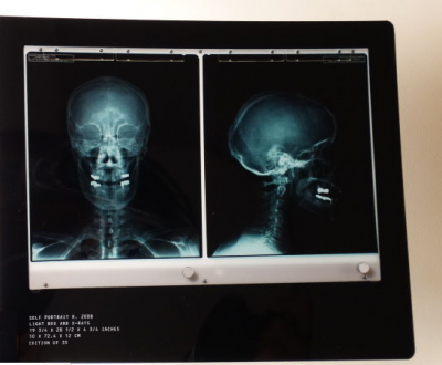 Damien Hirst - Rx Sefportrait - 2010 2