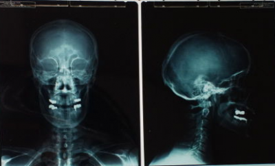 Damien Hirst - Rx Sefportrait - 2010 2