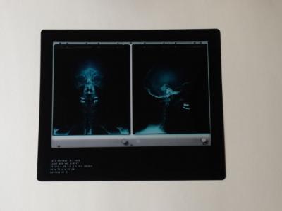 Damien Hirst - Rx Sefportrait - 2010 2