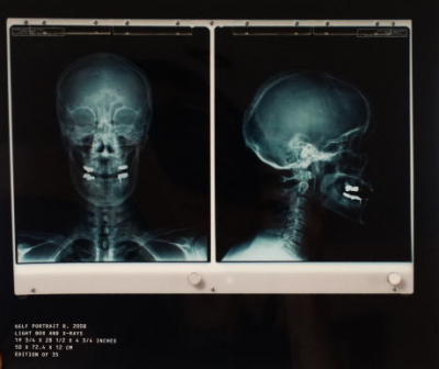 Damien Hirst - Autoportrait Radio 2