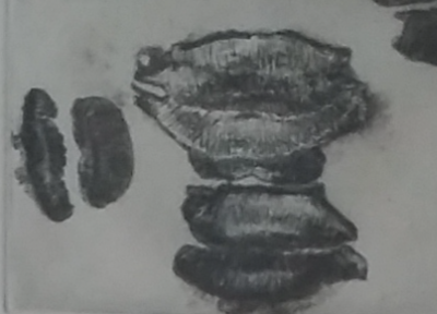 Donald Sultan  - Lips print, 1989 -  Gravure originale signée au crayon 2