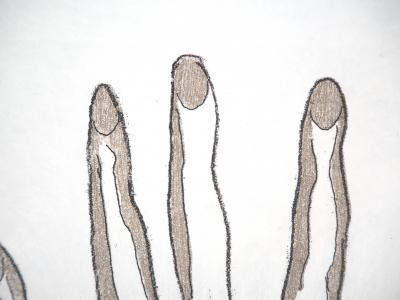 Man RAY - Femmes main dans la main - Aquatinte signée et numérotée 2
