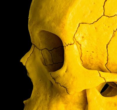 Mr Strange - Death in Yellow, 2021 - Giclée sur Aludibond 2