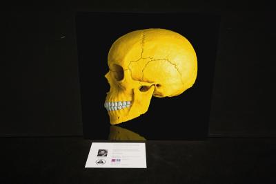 Mr Strange - Death in Yellow, 2021 - Giclée sur Aludibond 2