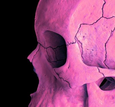 Mr Strange - Death in Pink, 2021 - Giclée sur Aludibond 2