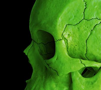 Mr Strange - Death in Green, 2021 - Giclée sur Aludibond 2