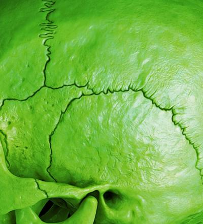 Mr Strange - Death in Green, 2021 - Giclée sur Aludibond 2