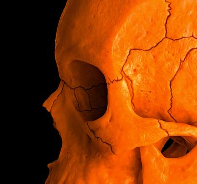 Mr Strange - Orange Skull, 2021 - Giclée sur panneau Aludibond 2