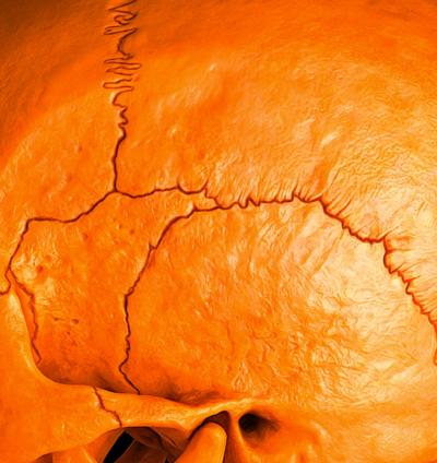 Mr Strange - Orange Skull, 2021 - Giclée sur panneau Aludibond 2