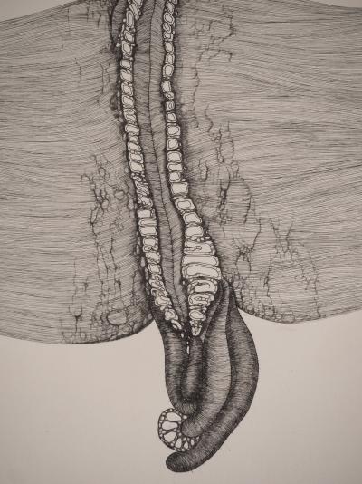 Fred DEUX : Blessure, Gravure originale signée 2